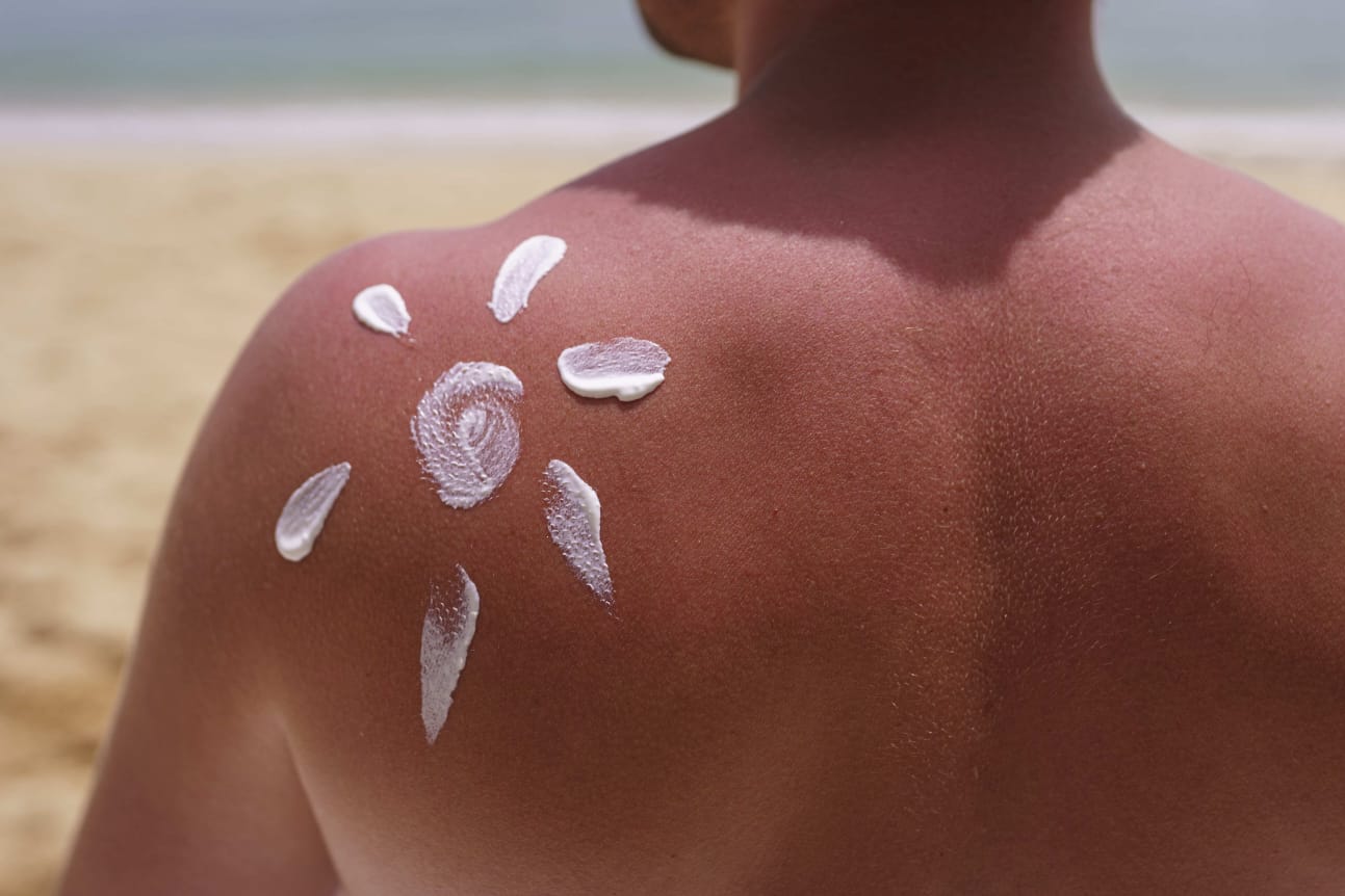 Carnaval - saiba como prevenir os efeitos do Sol na praia ou nos bloquinhos